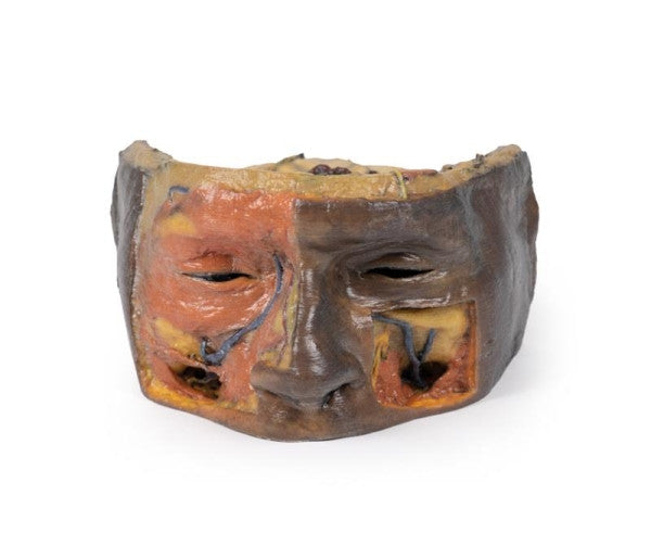 Orbit 3D Printed Anatomy Model