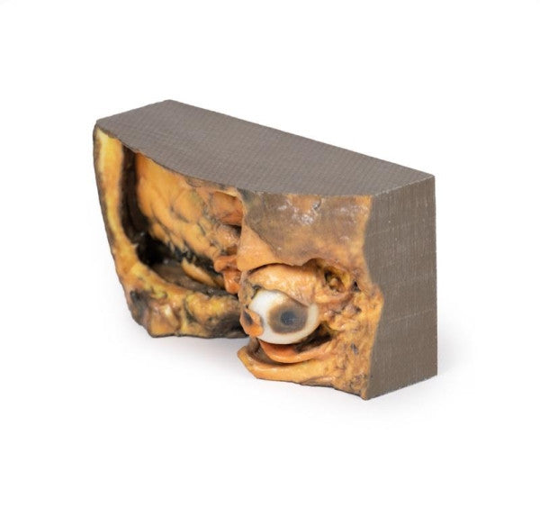 Orbit 3D Printed Anatomy Model