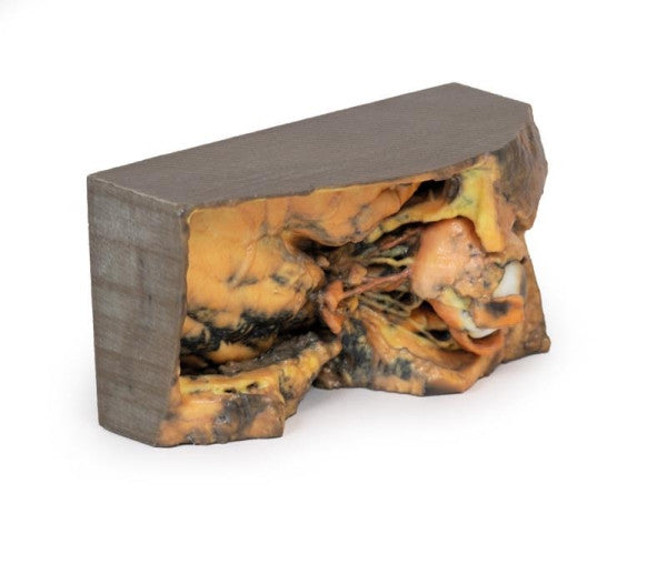 Orbit 3D Printed Anatomy Model