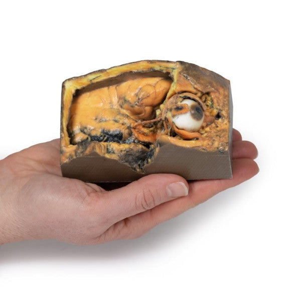 Orbit 3D Printed Anatomy Model