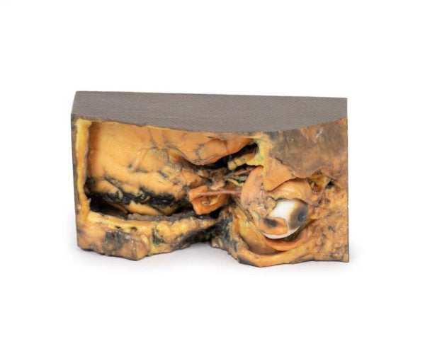 Orbit 3D Printed Anatomy Model