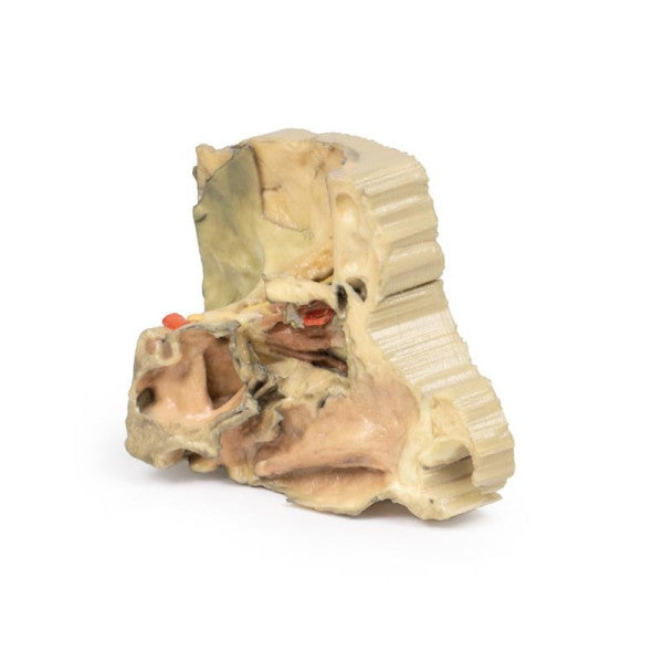 Orbit 3D Printed Anatomy Model