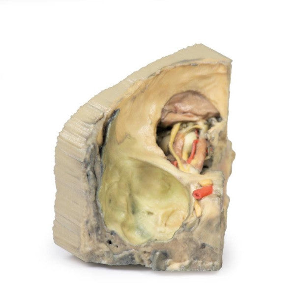 Orbit 3D Printed Anatomy Model