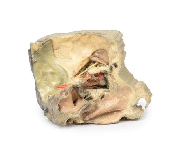 Orbit 3D Printed Anatomy Model