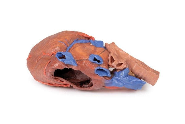 Heart 3D Printed Anatomy Model