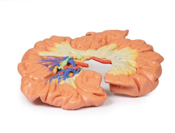 Bowel 3D Printed Anatomy Model
