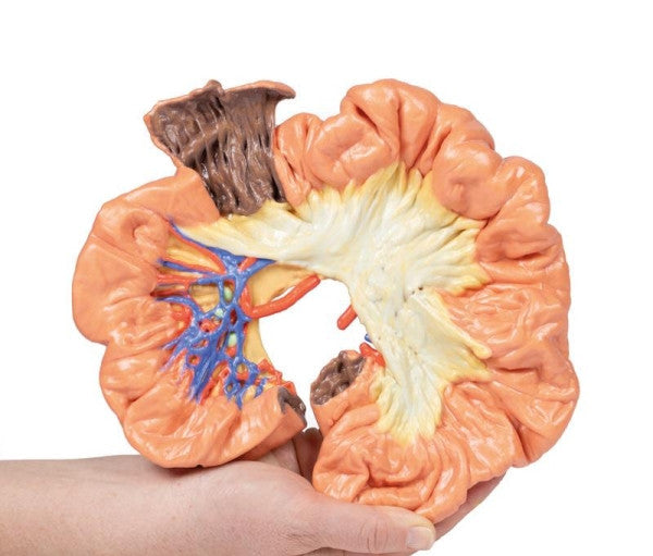 Bowel 3D Printed Anatomy Model