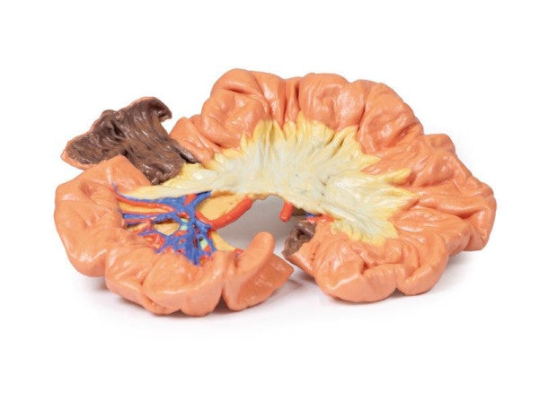 Bowel 3D Printed Anatomy Model