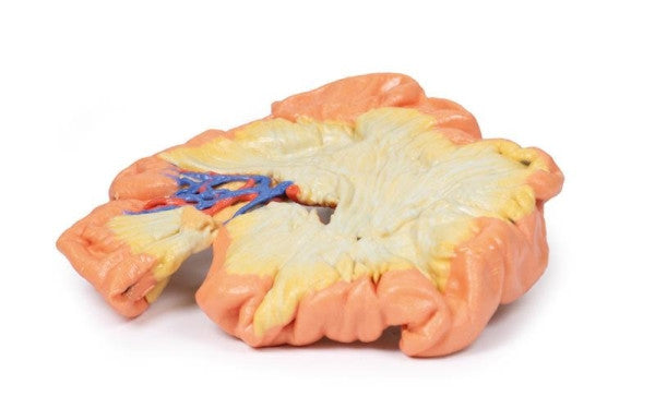 Bowel 3D Printed Anatomy Model
