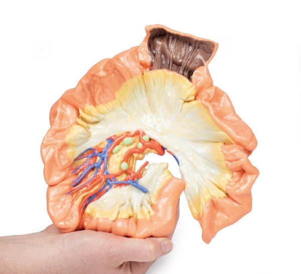 Bowel 3D Printed Anatomy Model