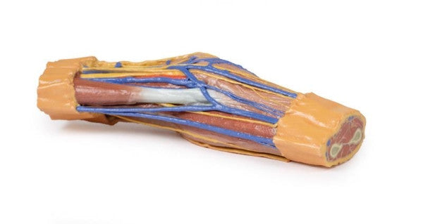 Cubital Fossa 3D Printed Anatomy Model
