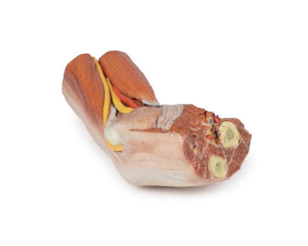 Cubital Fossa 3D Printed Anatomy Model