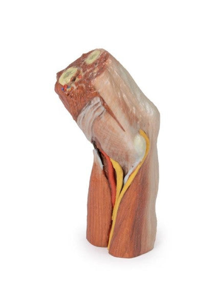 Cubital Fossa 3D Printed Anatomy Model