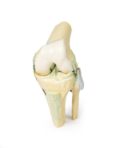 Knee Joint 3D Printed Anatomy Model