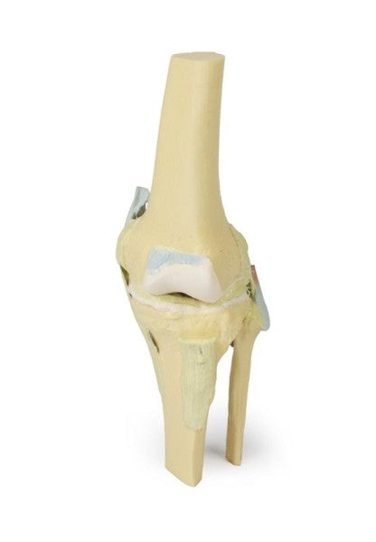 Knee Joint 3D Printed Anatomy Model
