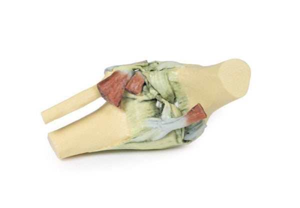 Knee Joint 3D Printed Anatomy Model