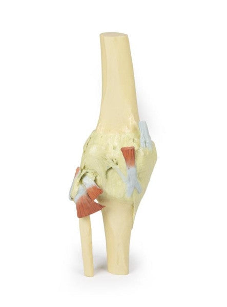 Knee Joint 3D Printed Anatomy Model