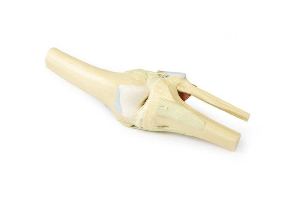 Knee Joint 3D Printed Anatomy Model