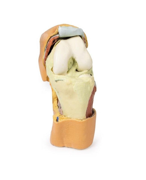 Knee Joint 3D Printed Anatomy Model