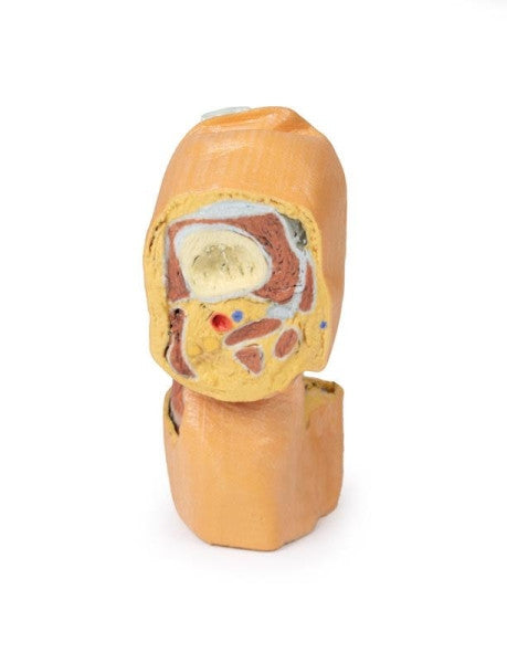 Knee Joint 3D Printed Anatomy Model