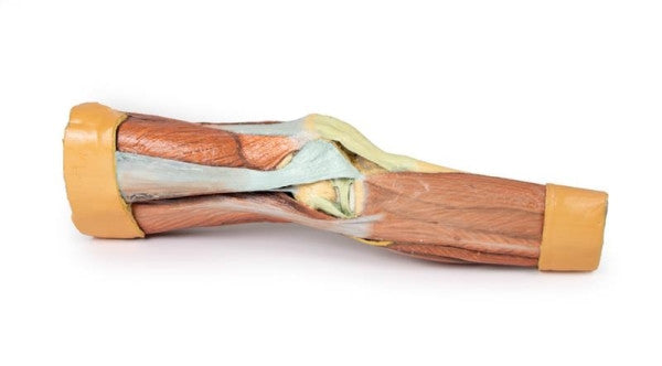 Lower Limb 3D Printed Anatomy Model