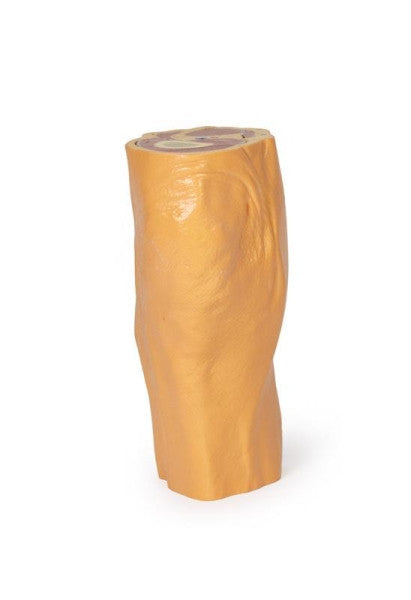 Popliteal Fossa 3D Printed Anatomy Model