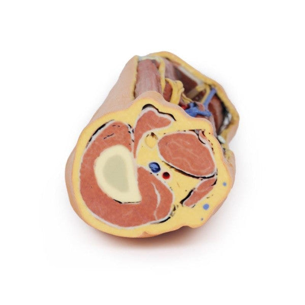 Popliteal Fossa 3D Printed Anatomy Model