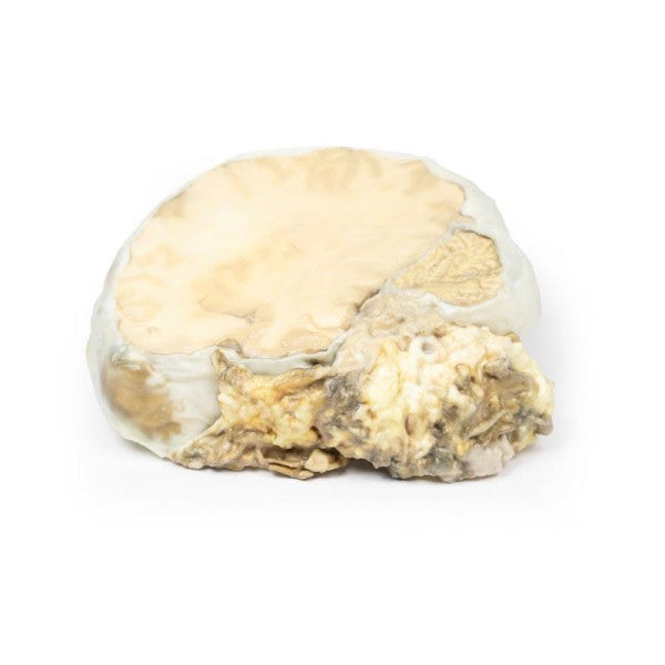 Adenoma 3D Printed Anatomy Model