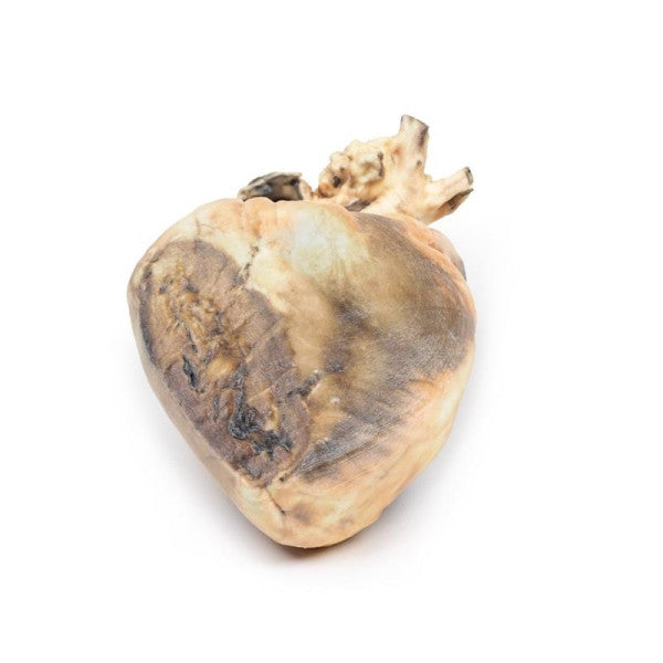 Heart Pathology 3D Printed Anatomy Model