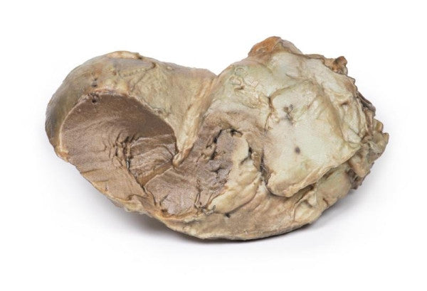 Posterior Aspect of the Bicuspid Aortic Valve Model