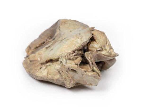 Valvular Disease 3D Printed Anatomy Model