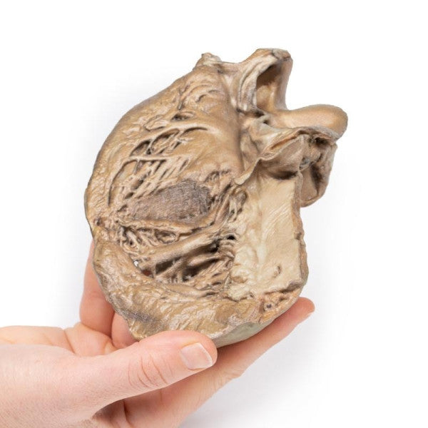 Valvular Disease 3D Printed Anatomy Model