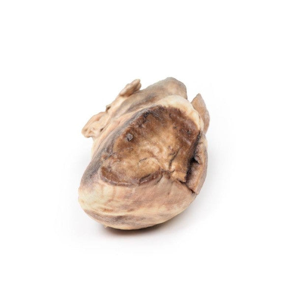 Valvular Disease 3D Printed Anatomy Model