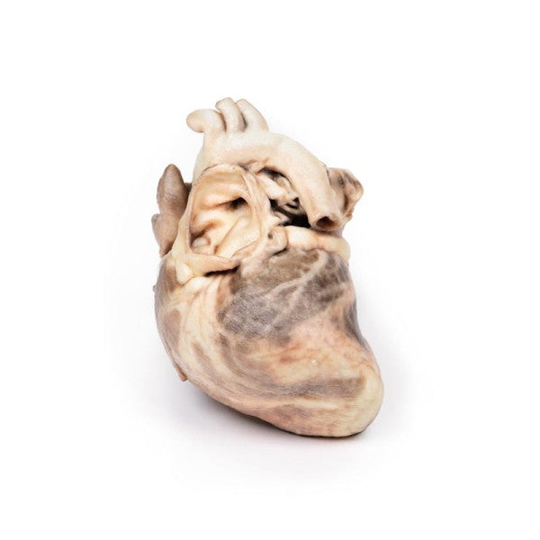 Valvular Disease 3D Printed Anatomy Model