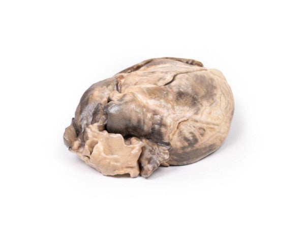 Superior View of the Hypertrophic Subaortic Stenosis 3D Printed Anatomy Model