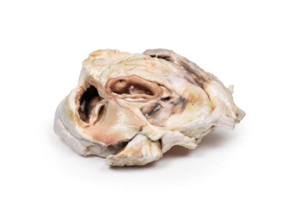 Lateral View of the Calcified Aortic Valvular Stenosis (Bicuspid Aortic Valve) Model