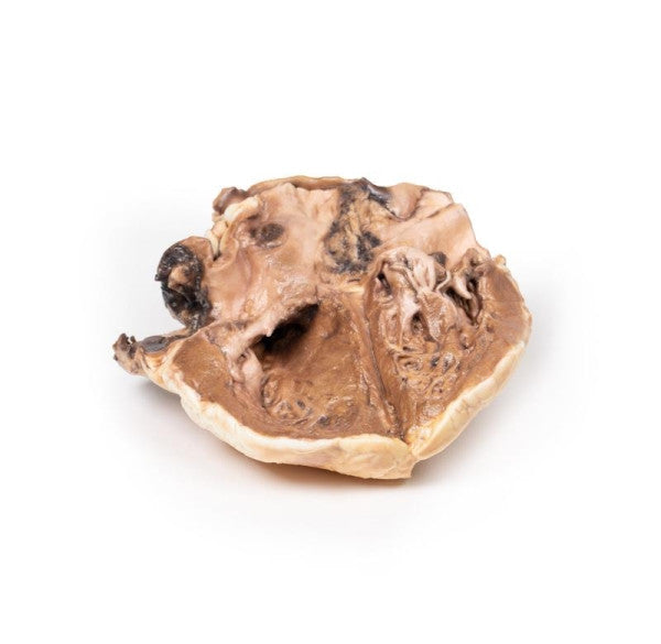 Rheumatic Endocarditis Model