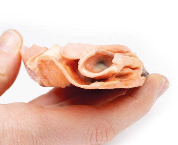 Oesophageal Pathology 3D Printed Anatomy Model