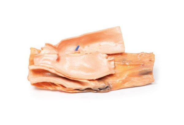 Oesophageal Pathology 3D Printed Anatomy Model