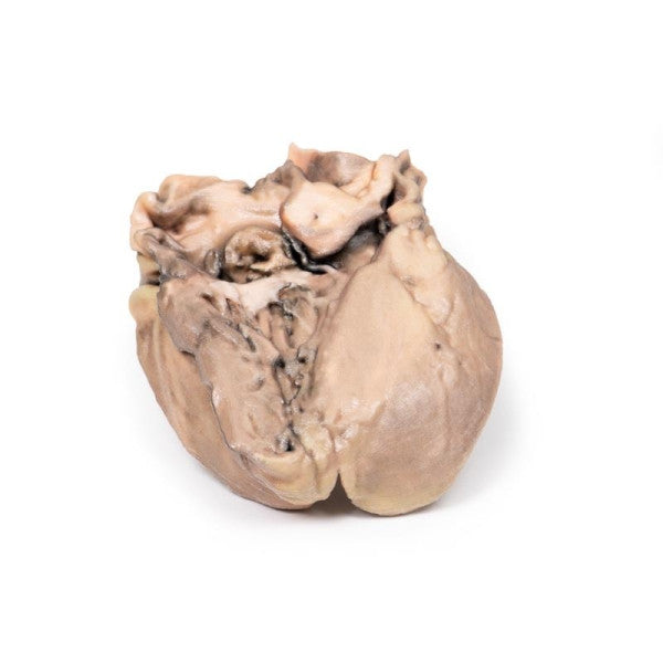 Posterior Aspect of the Acute Bacterial Endocarditis Model