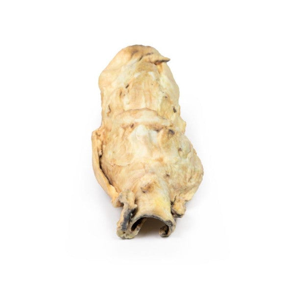 Carcinoma 3D Printed Anatomy Model