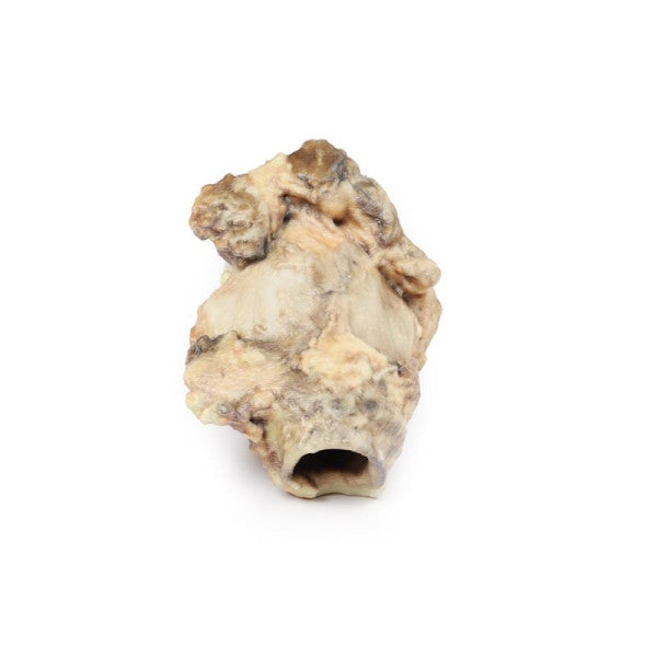 Carcinoma 3D Printed Anatomy Model