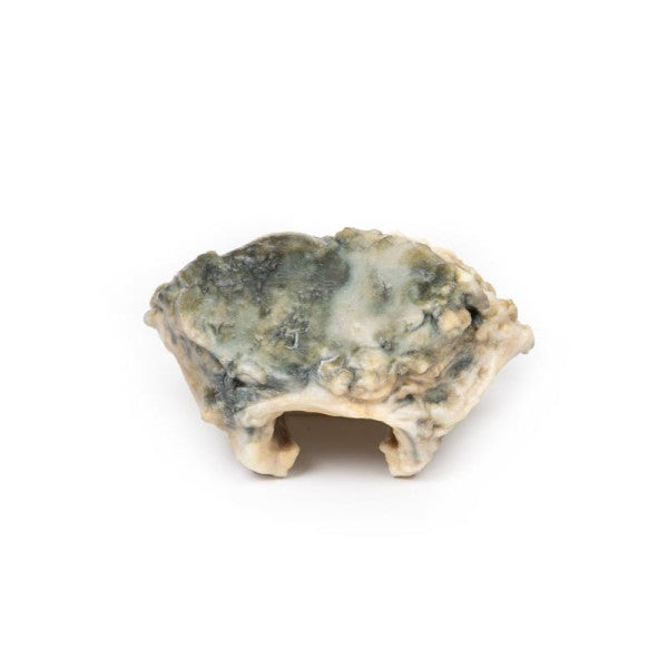 Carcinoma 3D Printed Anatomy Model