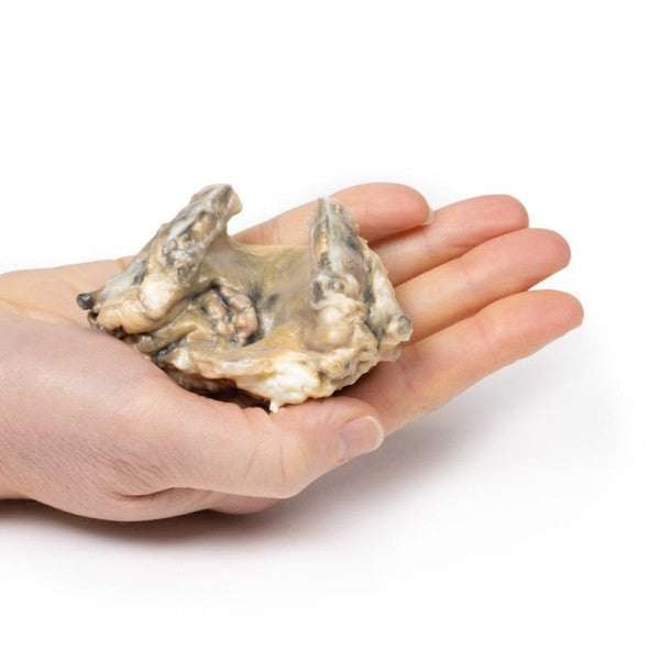 Carcinoma 3D Printed Anatomy Model