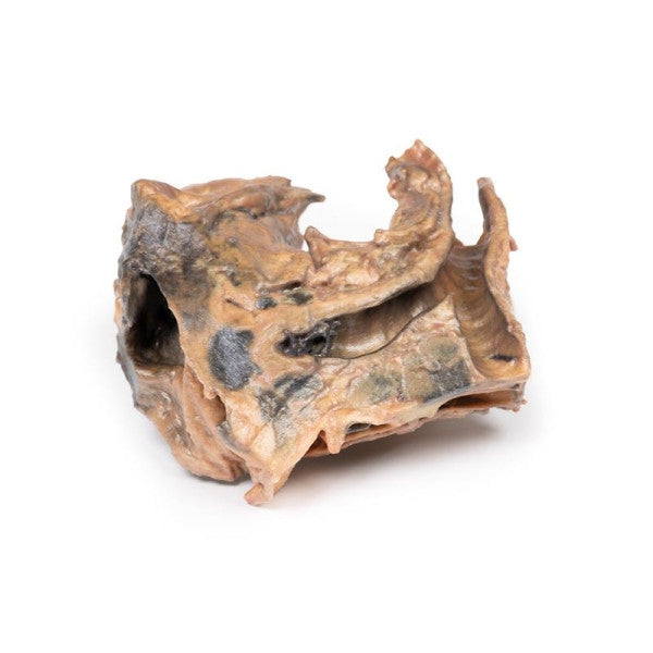 Inhaled Foreign Body Trachea 3D Printed Anatomy Model