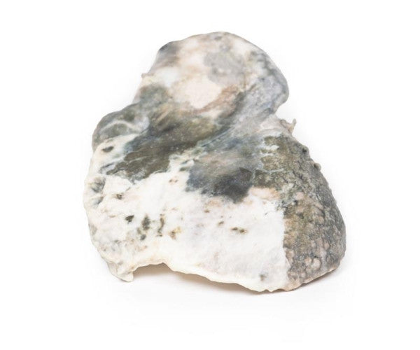 Tuberculosis 3D Printed Anatomy Model