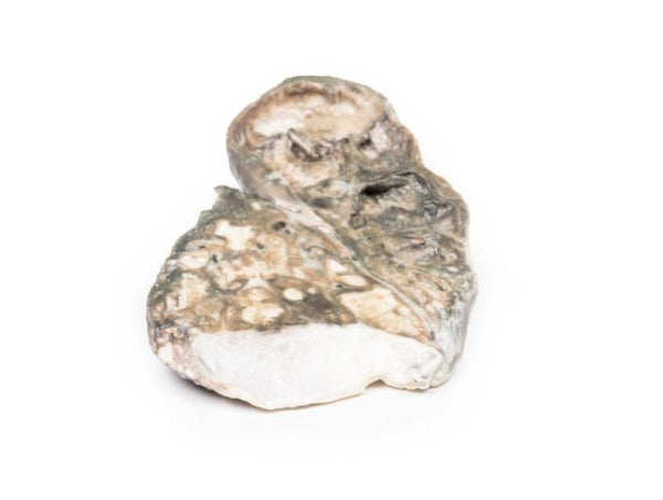 Tuberculosis 3D Printed Anatomy Model