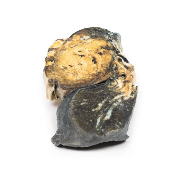 Metastatic Tumour in Lung from Primary Testicular Cancer 3D Printed Anatomy Model