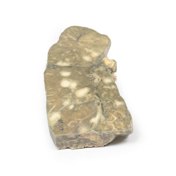 Carcinoma 3D Printed Anatomy Model