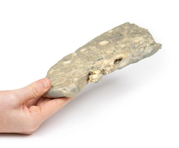 Carcinoma 3D Printed Anatomy Model